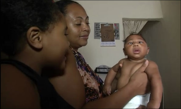 브라질에서 지카 바이러스에 감염된 산모가 낳은 소두증 걸린 아기의 모습