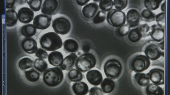 자가포식 현상 현미경 사진