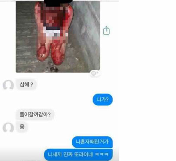 동네 후배를 폭행한 A 양은 피투성이가 된 여중생의 사진을 선배에게 보냈고 그 선배는 사진을 페이스북에 올렸다. 사진은 피투성이가 된 여중생의 사진이 올라온 SNS 대화 내용. 