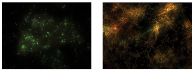 ‘그래핀’으로 감싼 세포(왼쪽)와 전자현미경으로 관찰한 세포(오른쪽)의 형광분석 이미지. 살아있는 세포는 녹색 형광색을 띠는데, 그래핀으로 감싼 세포 이미지에서 녹색이 확연하게 관찰된다.