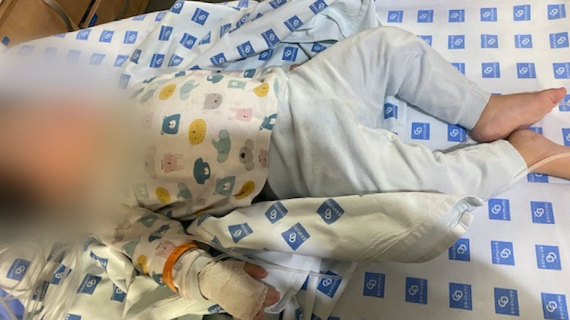 실수로 동전 크기의 ‘리튬 전지’를 삼켰던 세 살배기 아이. 충북대학교병원에서 응급 치료를 받았다.