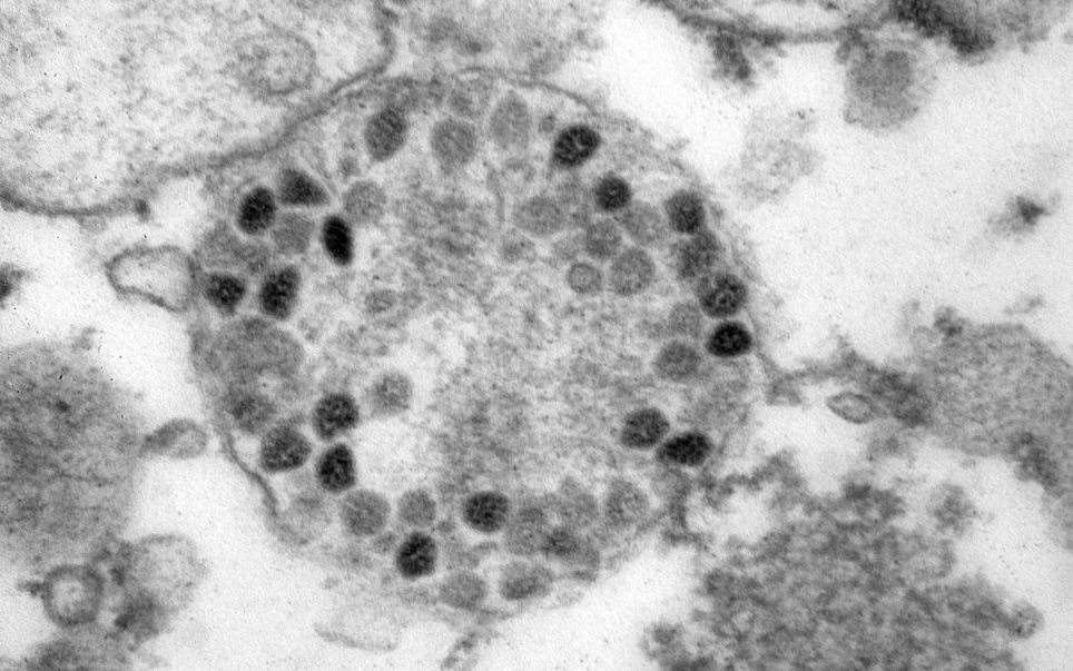 러시아 연구진이 촬영한 오미크론 변이 바이러스 현미경 사진