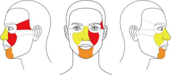자가운전 출퇴근 시 태양광에 취약한 얼굴지형 : 붉은색 표시 (눈 아래 · 관자놀이부위 -색소침참과 주름 과다 발생) 