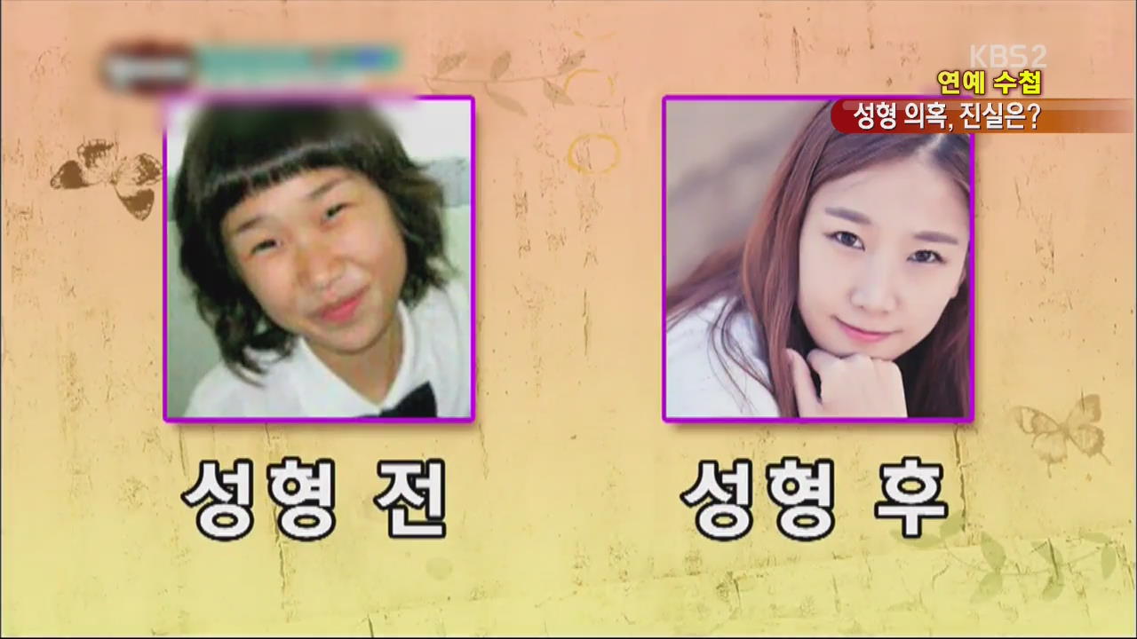 아이유 자막 합성 
