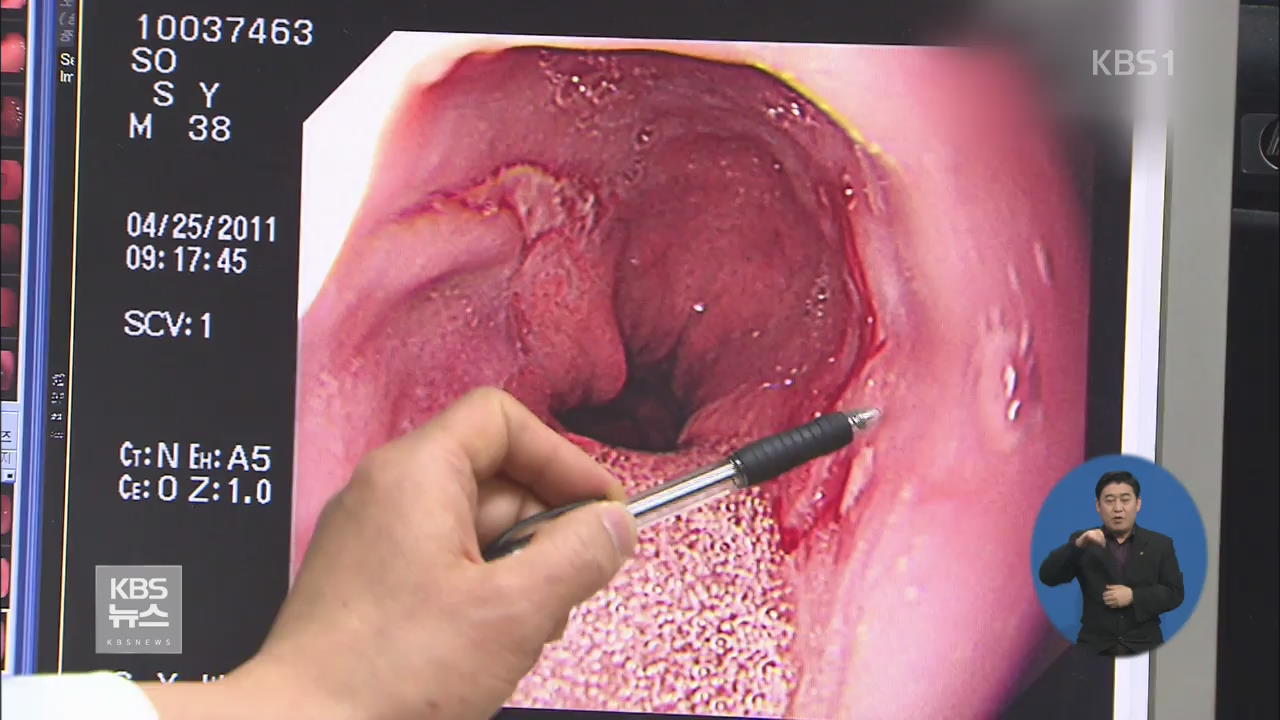 야근에 회식까지'…중년층 역류성 식도염 환자 급증
