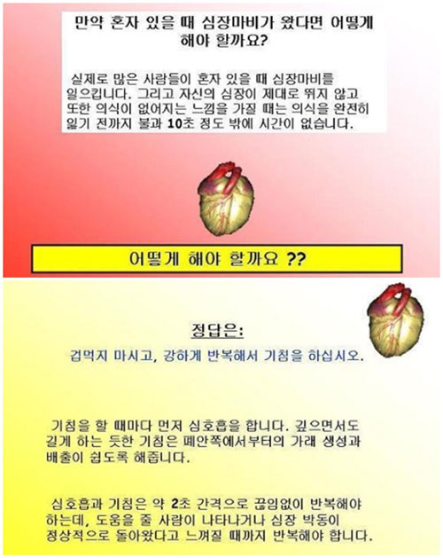 SNS에 떠도는 잘못된 ‘심장마비 대처법’ 정보