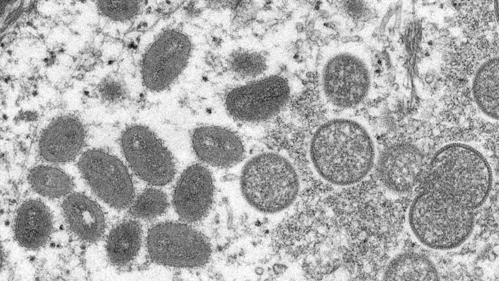 원숭이두창 바이러스 (사진 =AP)