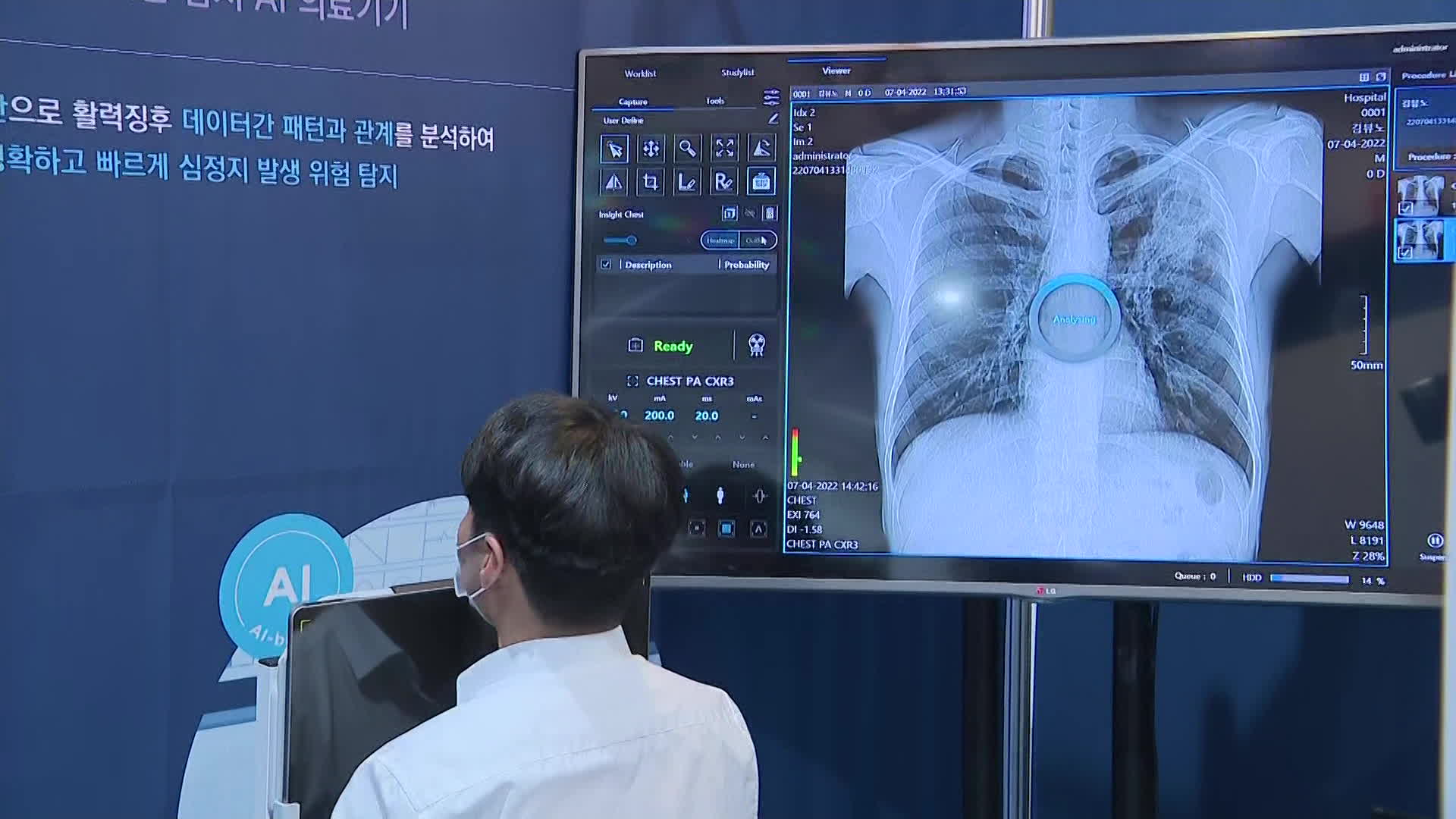 흉부질환 진단 인공지능이 탑재된 이동형 X-ray 장비