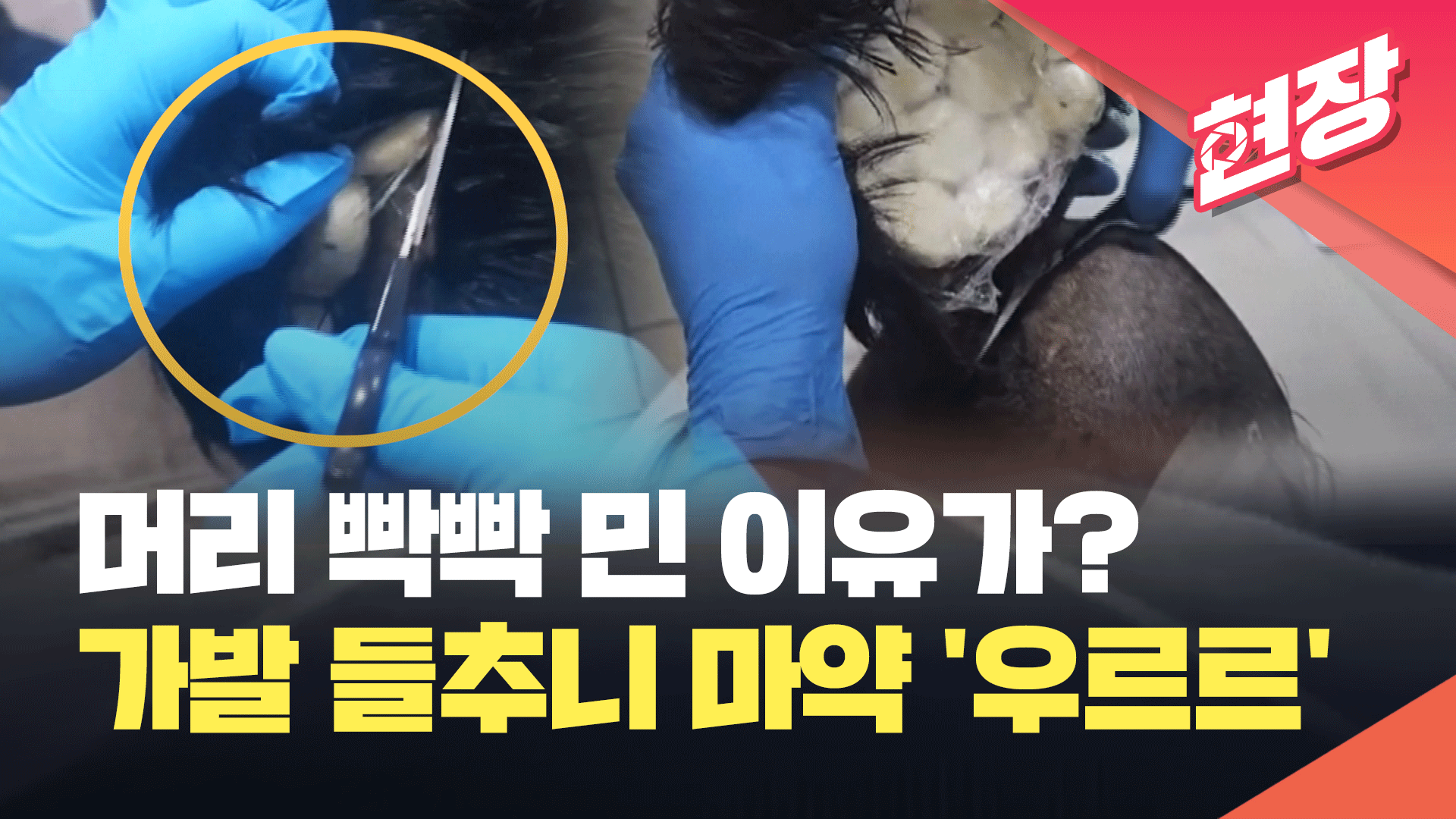 [영상] 머리 빡빡 민 이유가?…가발 들추니 마약이 ‘우르르’