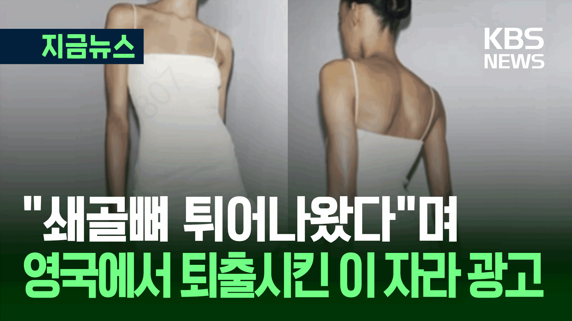 “안 건강해보여…퇴출!” 영국 광고 심의 기준이…