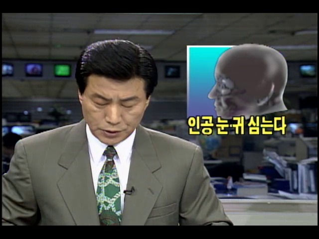 인공 눈.귀 심는 임플란트 기법 개발