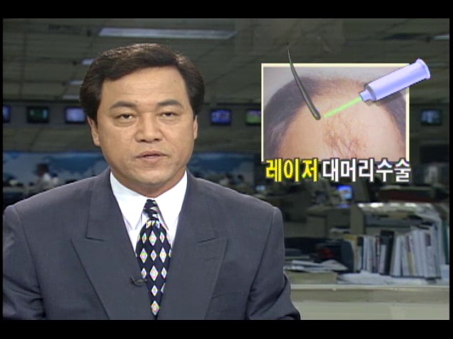 레이저 이용해 모발 이식하는 대머리 수술법 도입