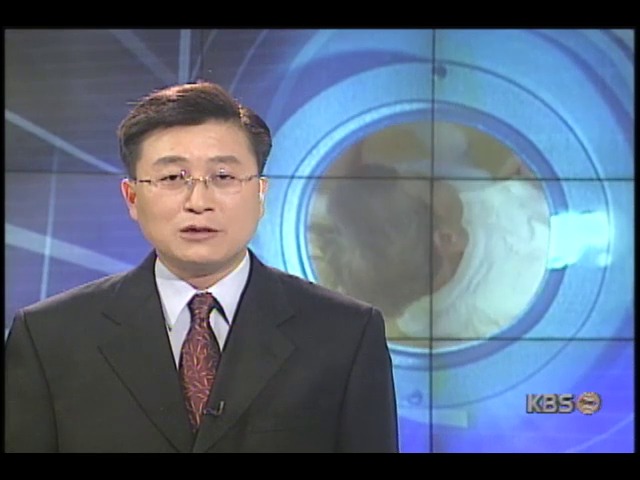 [집중취재] 노령화 사회, 치매노인 증가