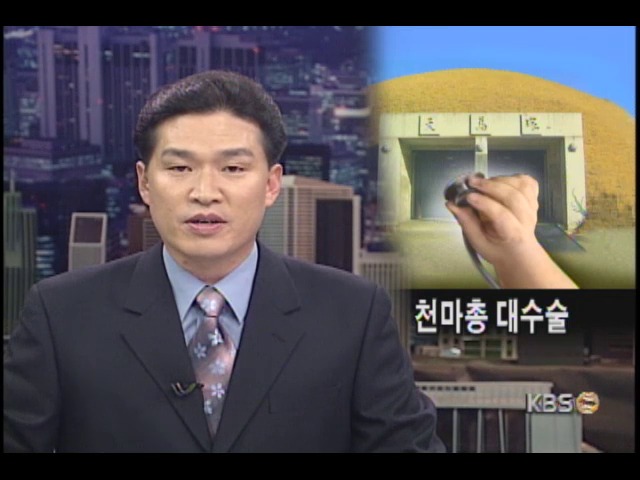 천마총은 대수술중 