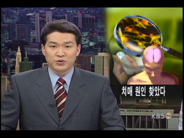 치매 발생원인 국내 연구진이 밝혀 