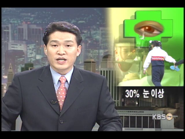 취학전 아동, 30% 눈 이상 