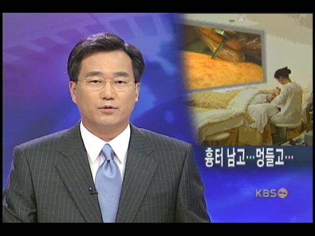 피부미용 서비스 부작용 심각 