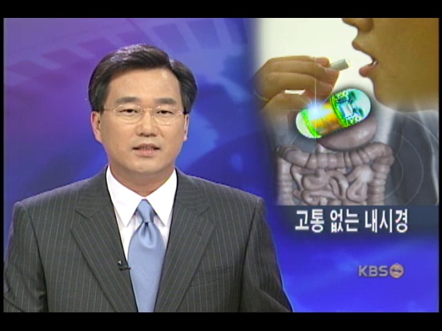 캡슐형 내시경 첫 선 