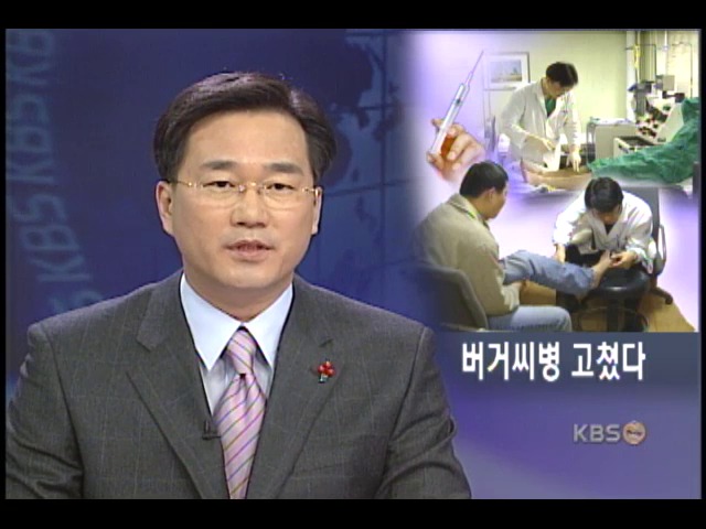 조혈모 세포이식으로 버거씨 병 첫 치료 