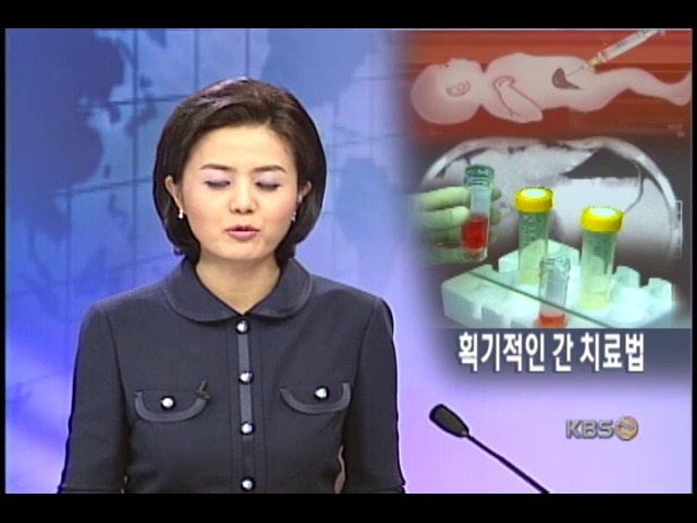 새로운 간질환 치료법 개발 
