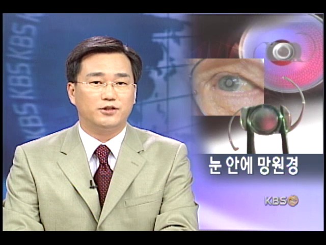 소형 망원경 이식으로 눈병 치료 