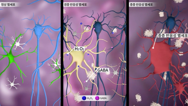 뇌 속 별세포 반응성 정도에 따른 형태 차이(제공화면 : IBS, KIST)