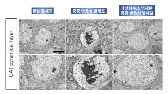 과산화수소를 억제한 중증 반응성 별세포 관찰(제공화면 : IBS, KIST)