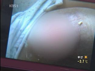 초등학생, 코치에게 몽둥이로 수십대 폭행당해