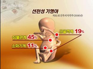 신생아 3% 선천성 기형…90% 이상 완치 가능
