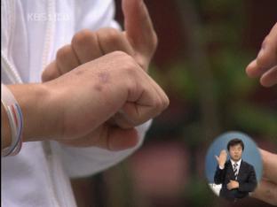“뺑소니 사고, 저녁시간대에 가장 많다”