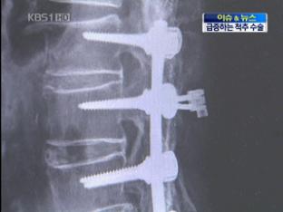 [이슈&뉴스] 척추 수술 급증…부작용 위험