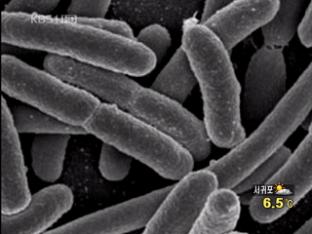 국내 ‘슈퍼 박테리아’ 첫 감염