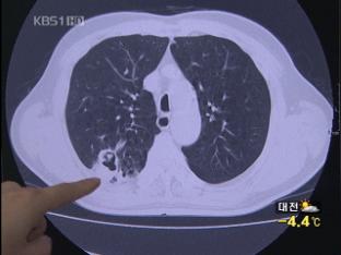 국내 암 환자 70만 명…췌장암·폐암이 문제