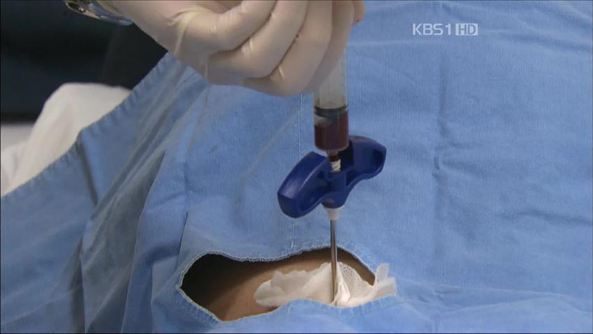 타인 골수 이식 성공률, 가족 수준과 비슷