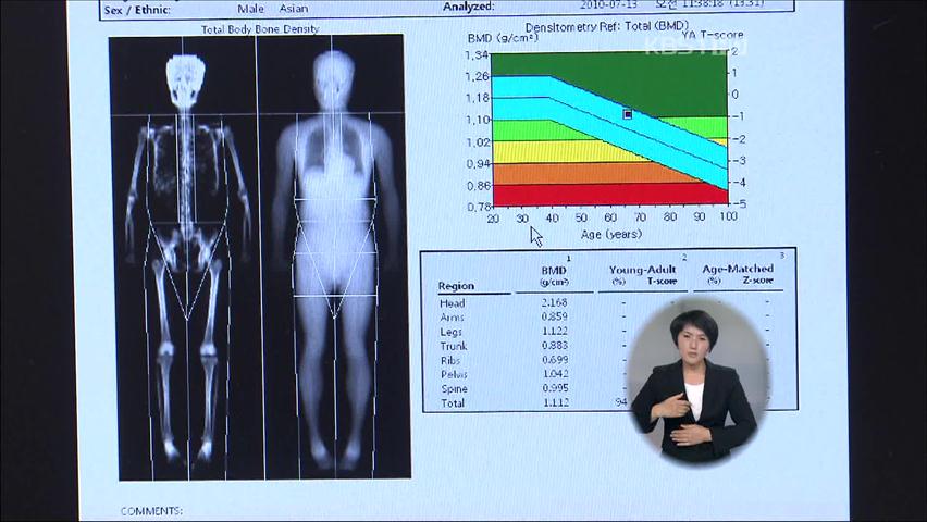 고혈압·당뇨 등 대사증후군 환자 급증