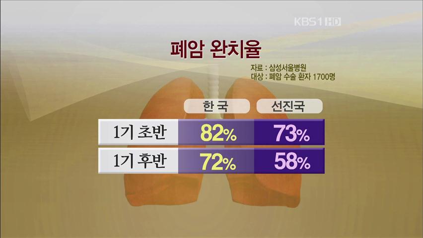 폐암 1기 생존율 82%, 세계 최고 수준