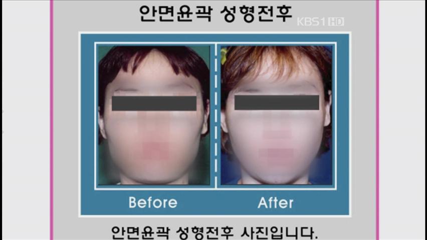 이렇게 하면 ‘초상권 침해’