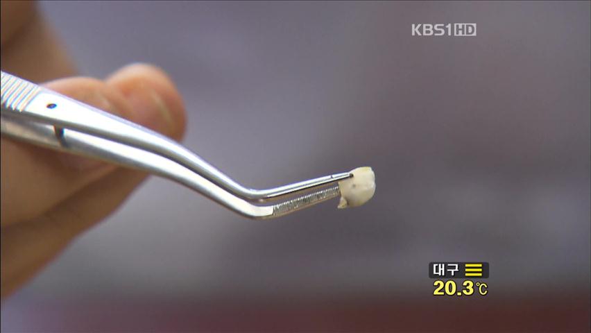 냉면 겨자소스에서 ‘어린이 치아’ 나와