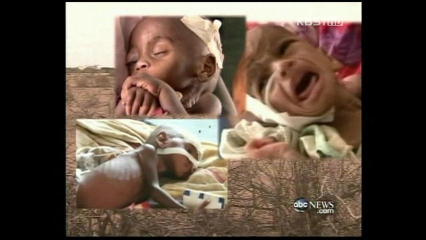 영양실조 시달리는 소말리아 어린이들