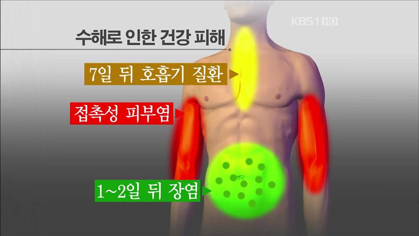 수해지역, 피부질환 등 2차 건강피해 우려