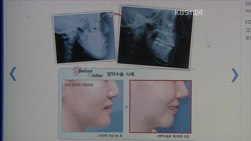 “양악수술 부작용 설명 안 해” 6천만 원 배상