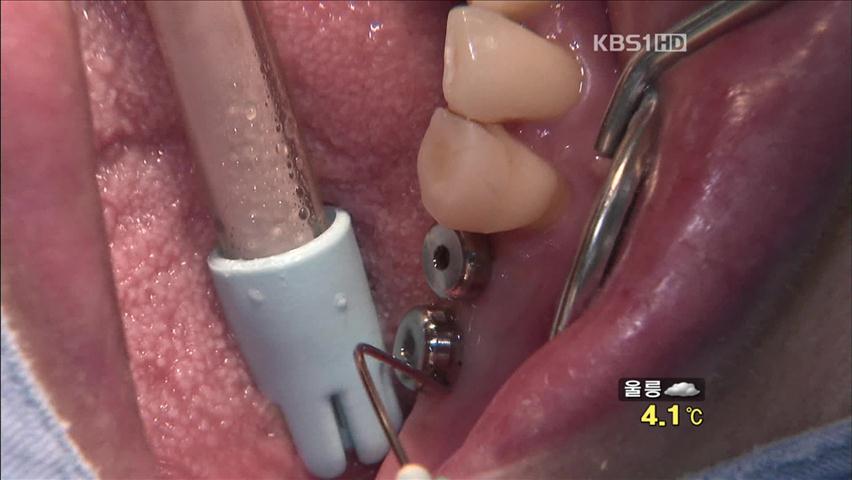 임플란트 소비자 피해 급증…과장광고 주의
