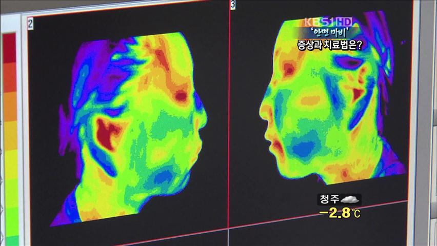 ‘안면 마비’ 증상과 치료법은?