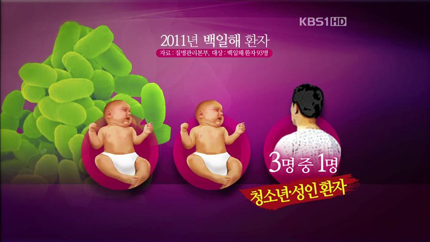 성인 ‘백일해’ 환자 발생, 10년 새 최고치