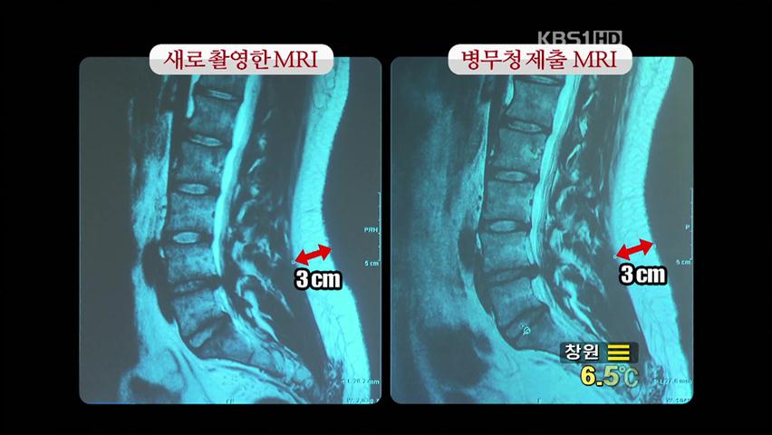 “박 시장 아들 MRI 맞다”…강용석 의원 사퇴