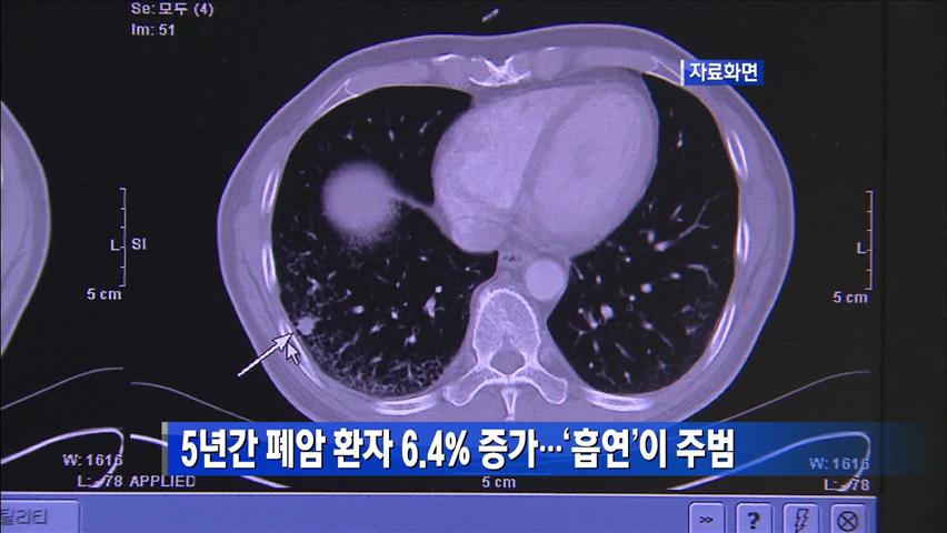 5년간 폐암 환자 6.4% 증가…흡연이 주범