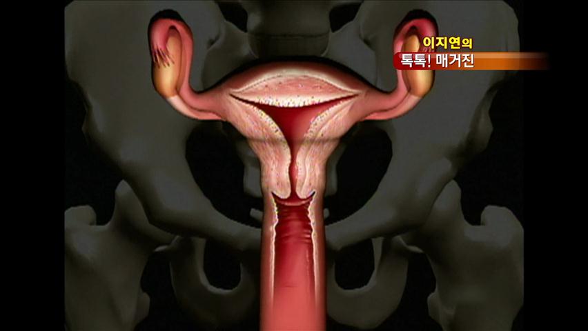 [톡톡! 매거진] 자궁경부암 예방접종 오해와 진실 外