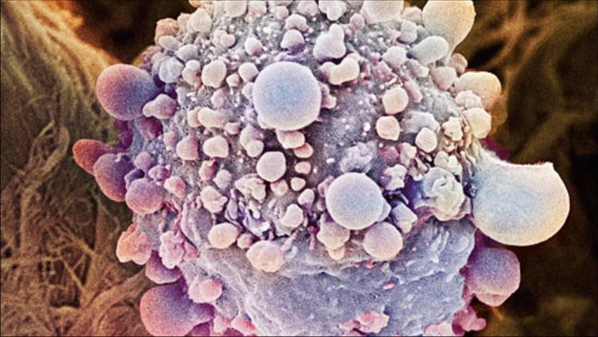 암세포와 정상세포 구분하는 새 기술 개발