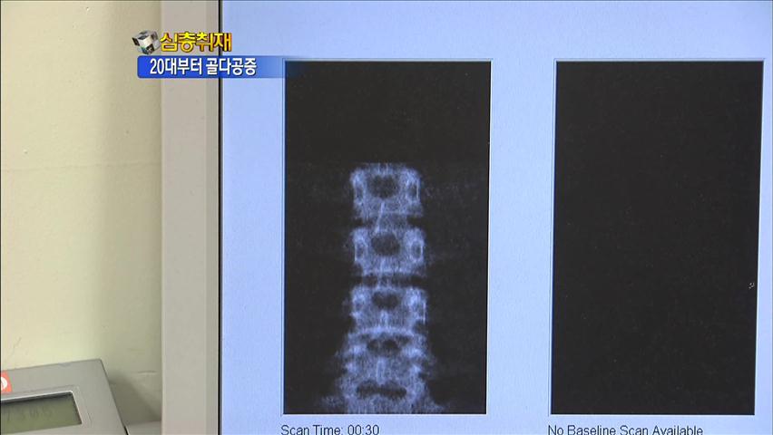 [심층취재] 20대 뼈 건강 적신호…이유는?