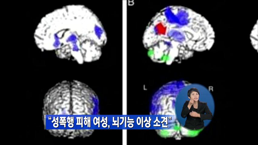 “성폭행 피해 여성, 뇌 기능 이상 소견”